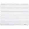 Universal Dry Erase Board
